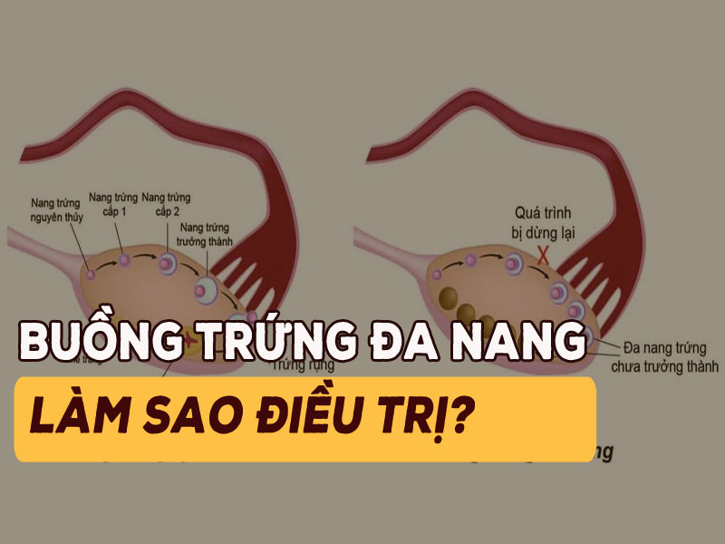 buong trung da nang